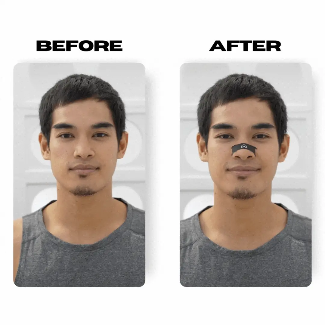 Before and after comparison showing PeakFlow nasal strip applied